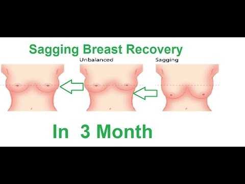 Breast Treatment center.. in Chandigarh, Haryana 160101 - Free Business Listing